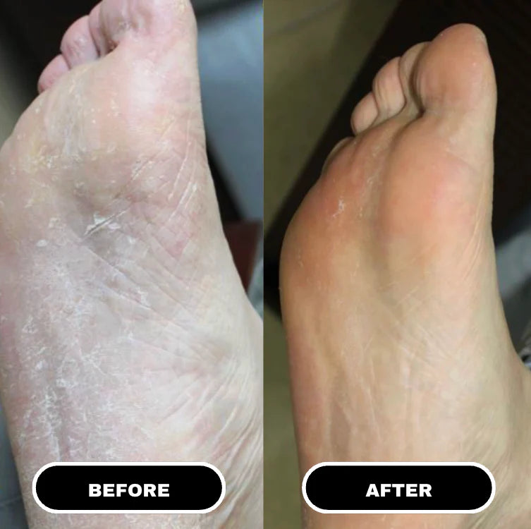 HeelRenew Stick